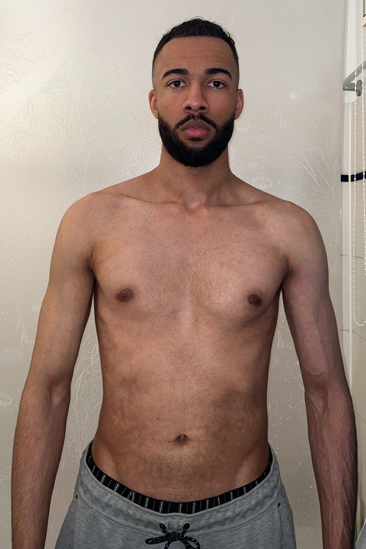 Before Transformation 1